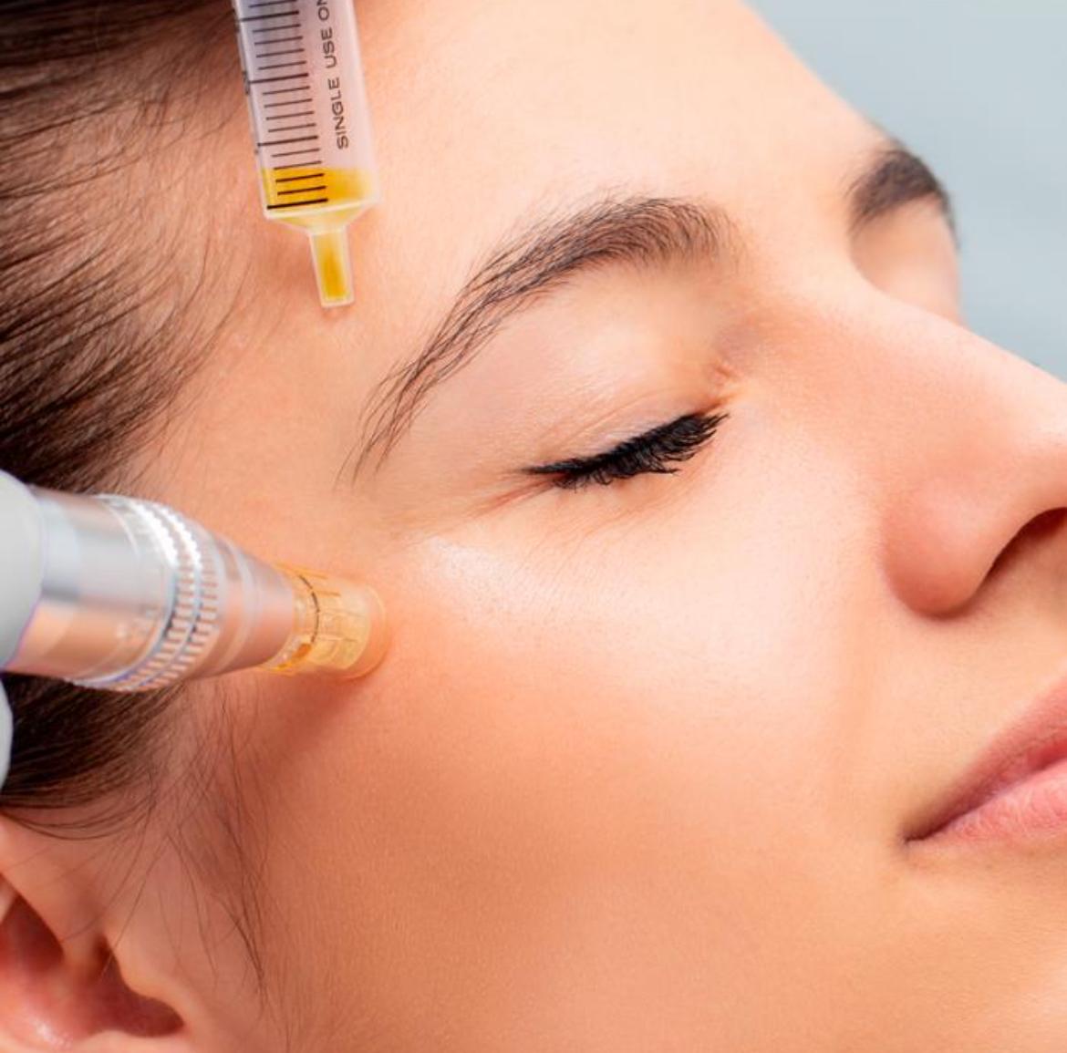 microneedling microneedling